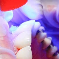 Намерете най-добрите оферти за коронки на зъби 26