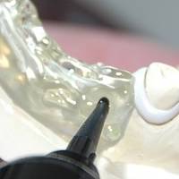 Изключително качествени коронки на зъби 3