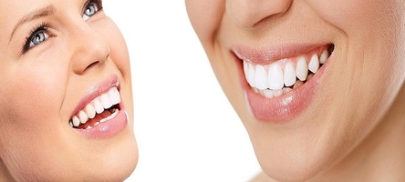 Ефектни зъбни импланти цени 24